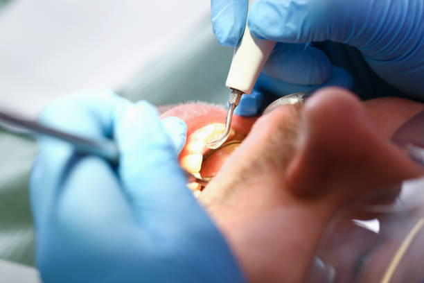 Best Orthodontic Emergency Dentist in Star, NC