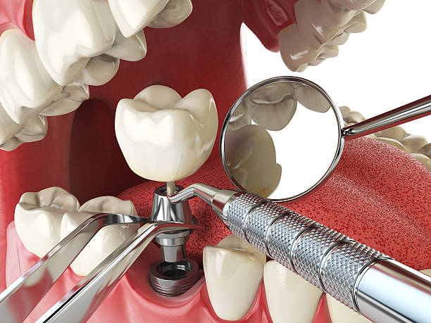 Best Emergency Dental Extractions in Star, NC