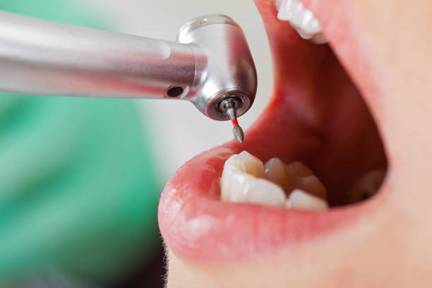 Best Emergency Cosmetic Dentistry in Star, NC